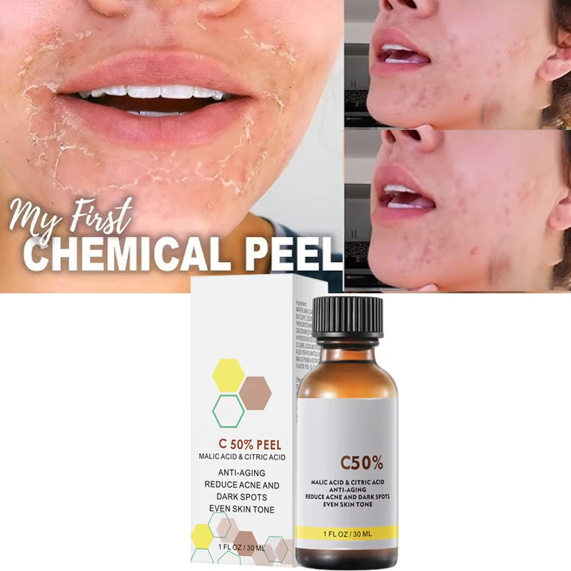 Salicylic Acid Cleanser - With Malic Acid And Citric Acid