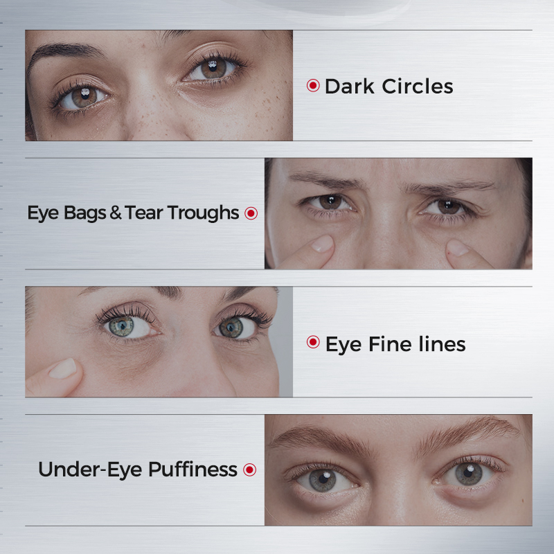 Eye Patches for Dark Circles – - đánh giá và giá Collagen Sheet Mask