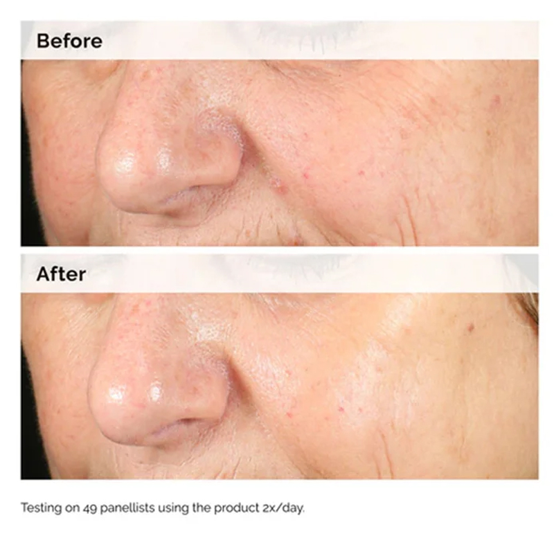 Alpha Arbutin 2% + HA 30ml Ser - đánh giá và giá Alpha Arbutin Serum