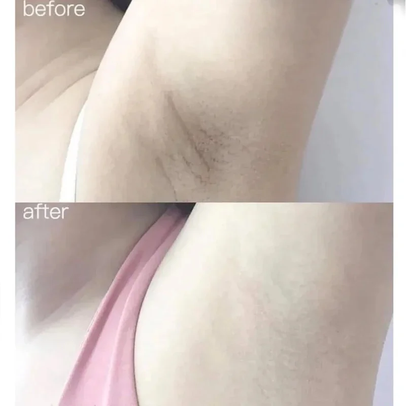 100ml Alpha Arbutin Collagen W - đánh giá và giá Alpha Arbutin Serum