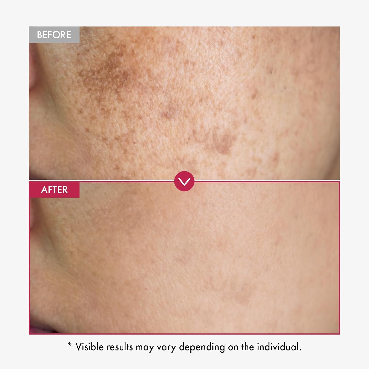Alpha Arbutin Serum AHA Keeps  - đánh giá và giá Alpha Arbutin Serum