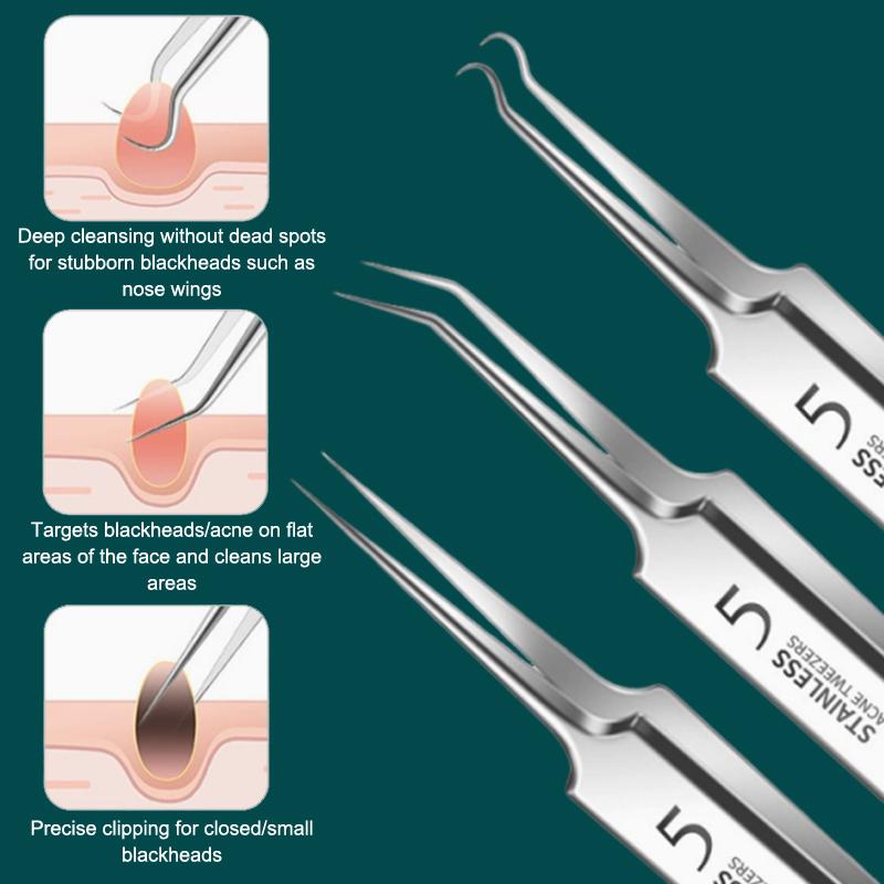 7/8Pcs Blackhead Remover Kit P - đánh giá và giá Skincare You