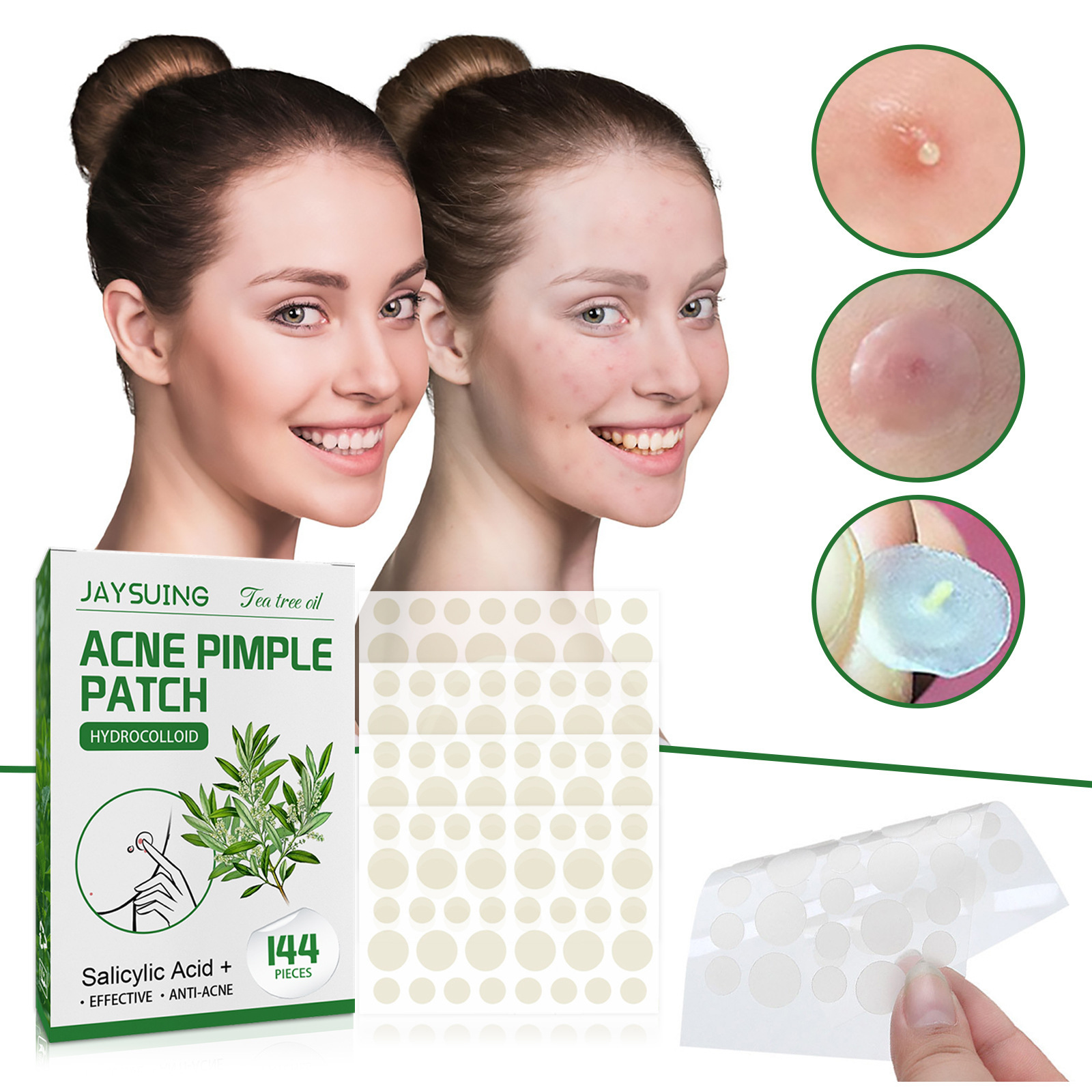 Hydrocolloid Acne Patches - Ab - đánh giá và giá Skincare Moisturizer