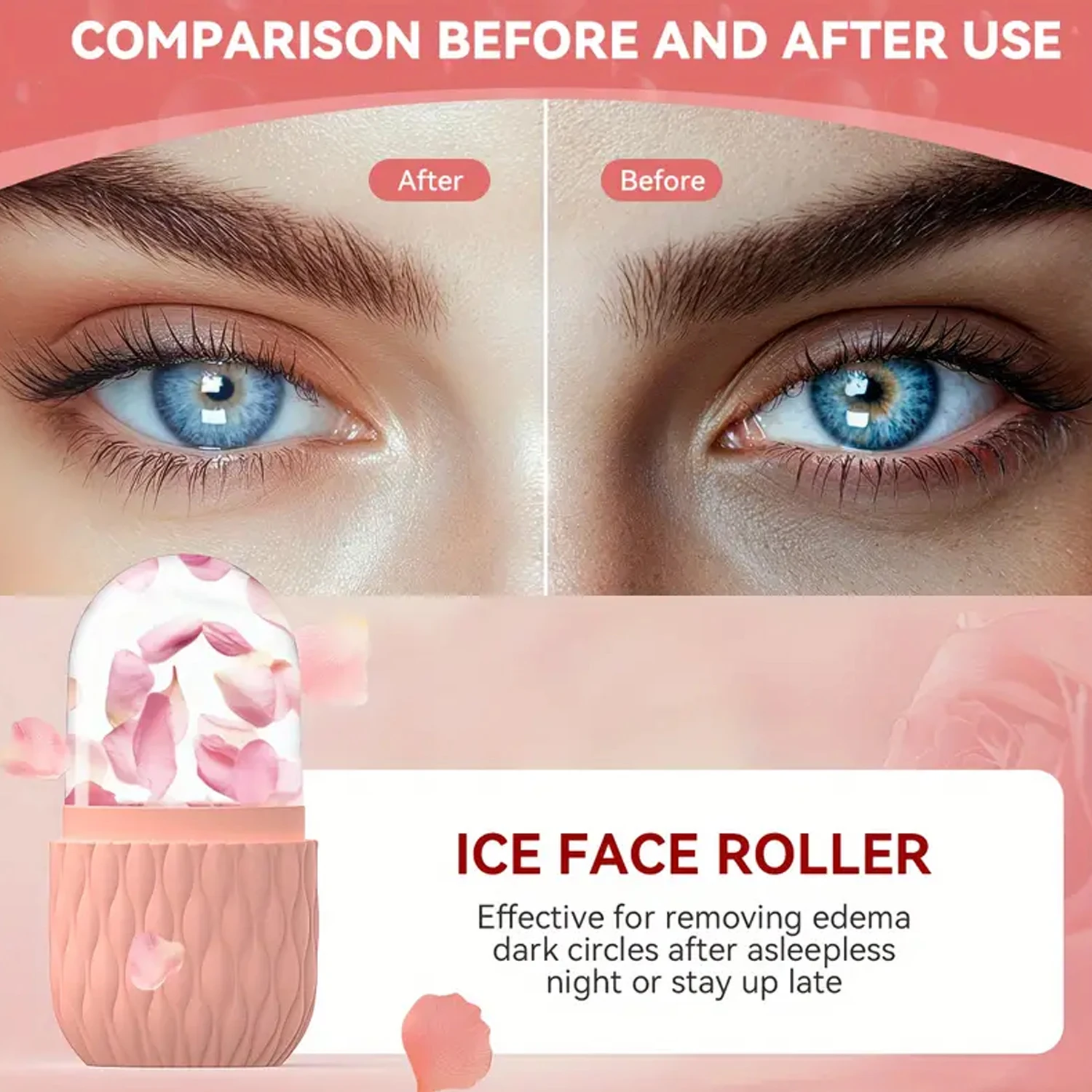 Ice Roller & Stainless Steel G - đánh giá và giá Skincare Natur E