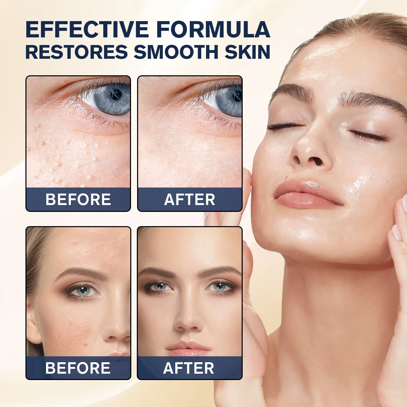 Milia Remover Essence Treatmen - đánh giá và giá Hyaluronic Acid Serum