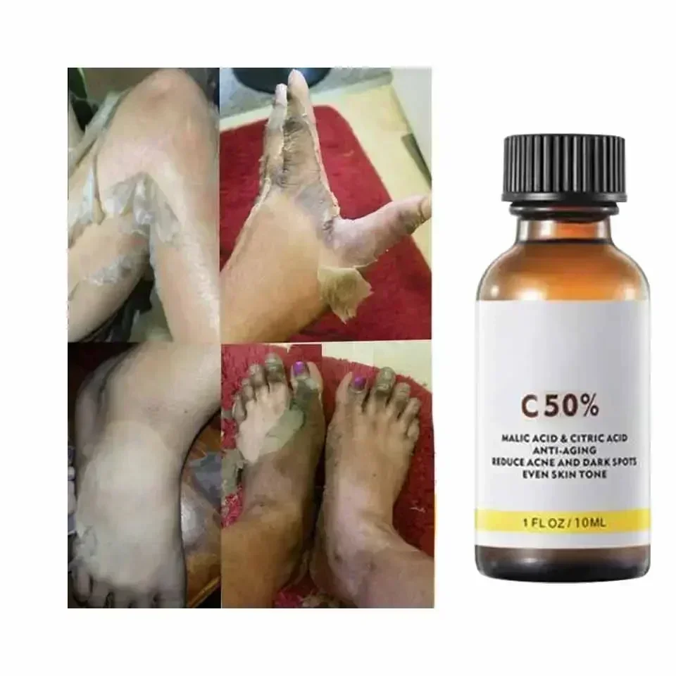 With Malic Acid And Citric Aci - đánh giá và giá Salicylic Acid Cleanser