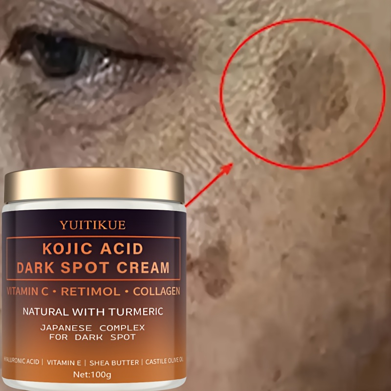 Arbutin fading cream, Vitamin  - đánh giá và giá Retinol Vitamin A Cream