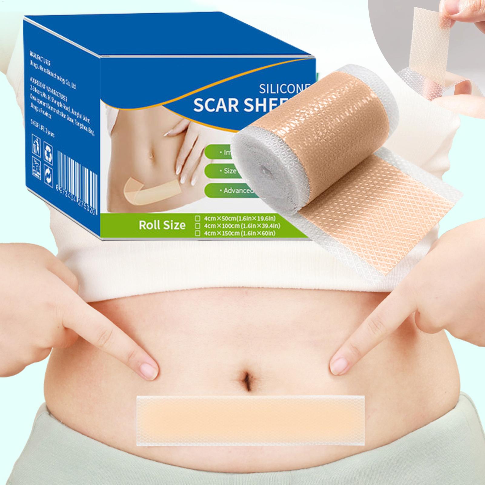 1 Roll Silicone Scar Sheets 4c - đánh giá và giá Collagen Sheet Mask